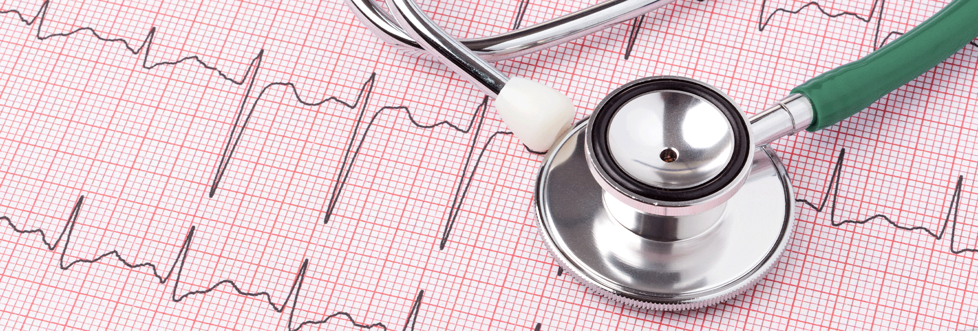 Nem vesszük komolyan szívünk egészségét